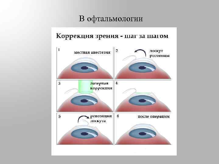 В офтальмологии 