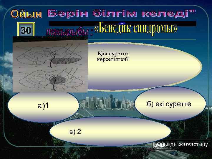 30 Қаи суретте көрсетілген? б) екі суретте а)1 в) 2 Ойынды жалғастыру 