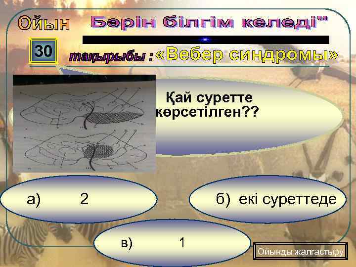 30 Қай суретте көрсетілген? ? а) 2 б) екі суреттеде в) 1 Ойынды жалғастыру