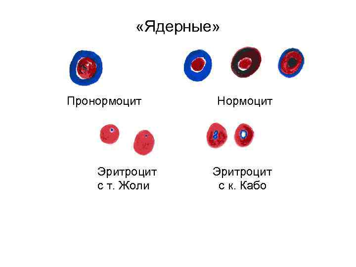  «Ядерные» Пронормоцит Эритроцит с т. Жоли Нормоцит Эритроцит с к. Кабо 