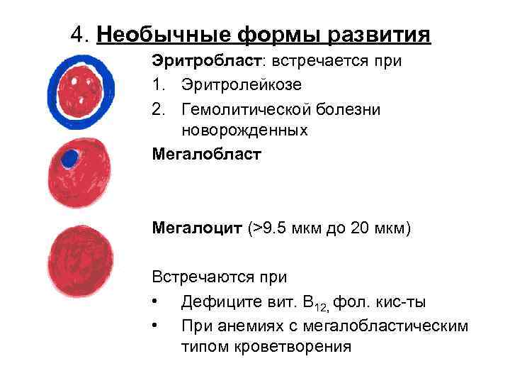4. Необычные формы развития Эритробласт: встречается при 1. Эритролейкозе 2. Гемолитической болезни новорожденных Мегалобласт