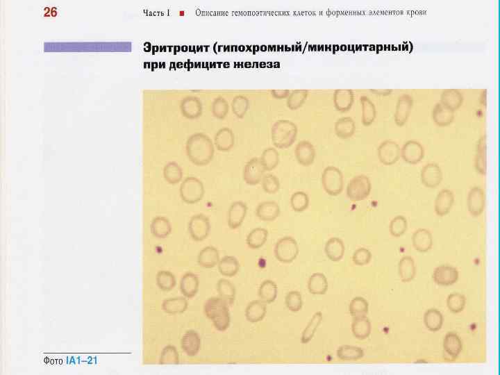 Анемия типовой патологический процесс thumbnail