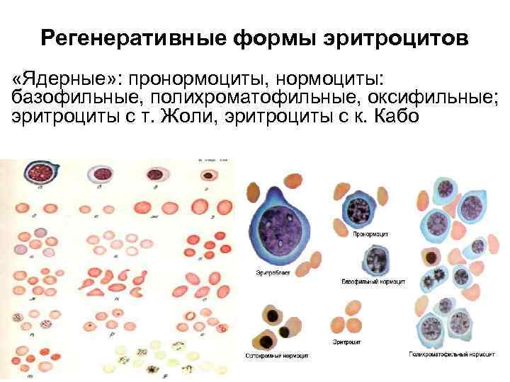 Регенеративные формы эритроцитов «Ядерные» : пронормоциты, нормоциты: базофильные, полихроматофильные, оксифильные; эритроциты с т. Жоли,