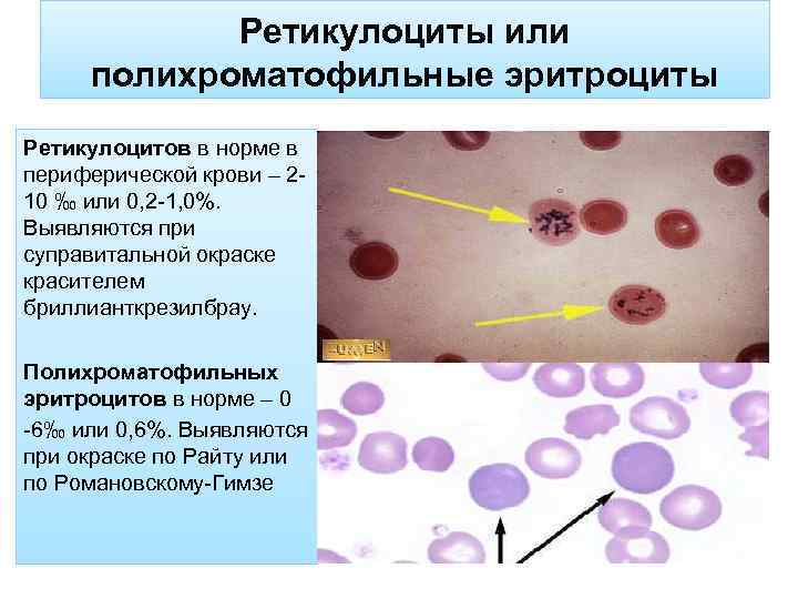 Ретикулоциты или полихроматофильные эритроциты Ретикулоцитов в норме в периферической крови – 210 ‰ или