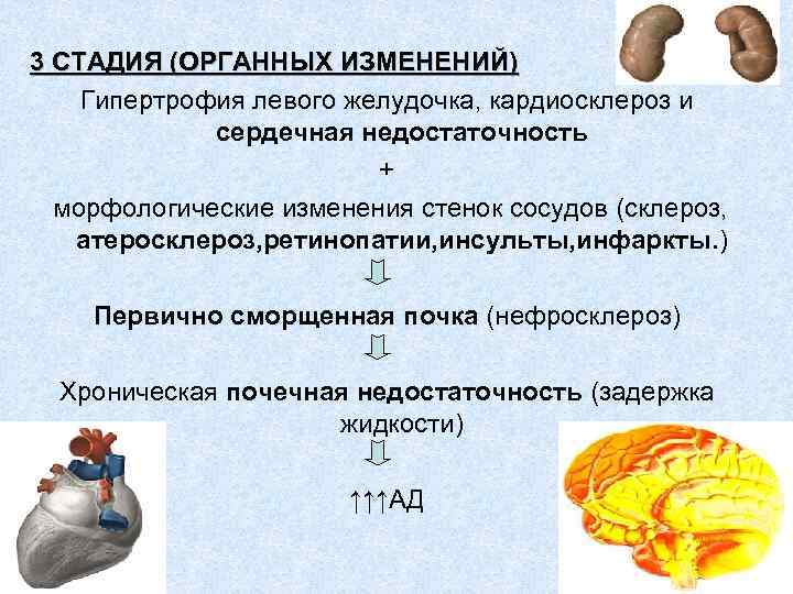 3 СТАДИЯ (ОРГАННЫХ ИЗМЕНЕНИЙ) Гипертрофия левого желудочка, кардиосклероз и сердечная недостаточность + морфологические изменения