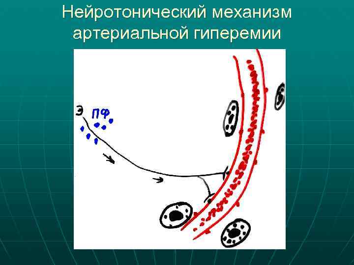 Нейротонический механизм артериальной гиперемии 