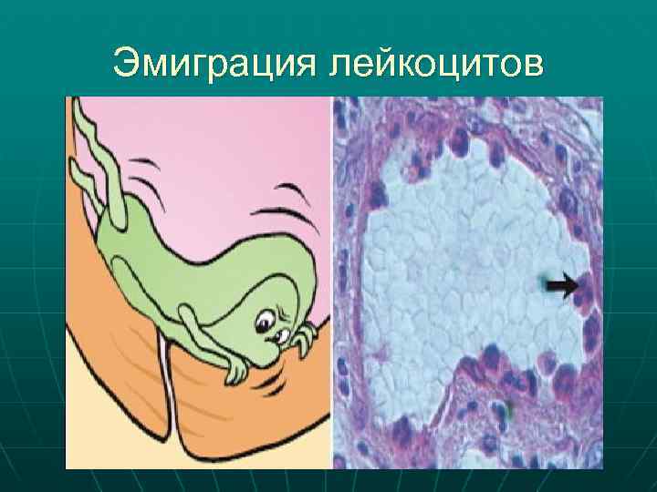 Эмиграция лейкоцитов 