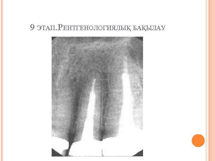 9 ЭТАП. РЕНТГЕНОЛОГИЯЛЫҚ БАҚЫЛАУ 