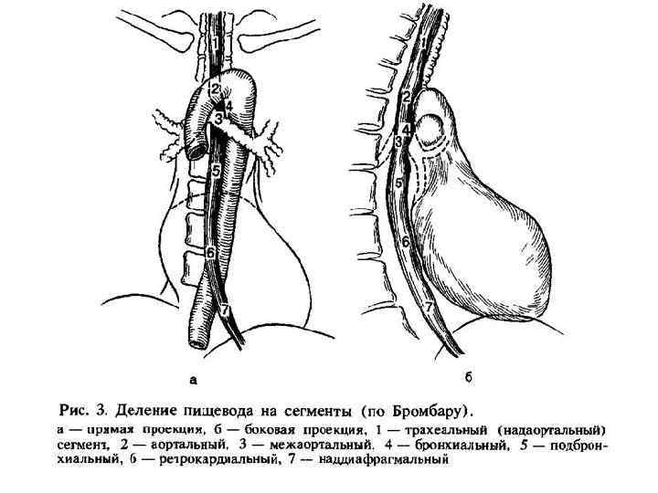 Лучевая диагностика пищевода презентация