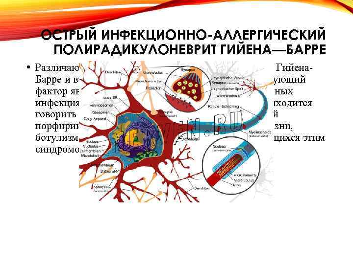 ОСТРЫЙ ИНФЕКЦИОННО-АЛЛЕРГИЧЕСКИЙ ПОЛИРАДИКУЛОНЕВРИТ ГИЙЕНА—БАРРЕ • Различают первичный острый полирадикулоневрит Гийена. Барре и вторичные формы,