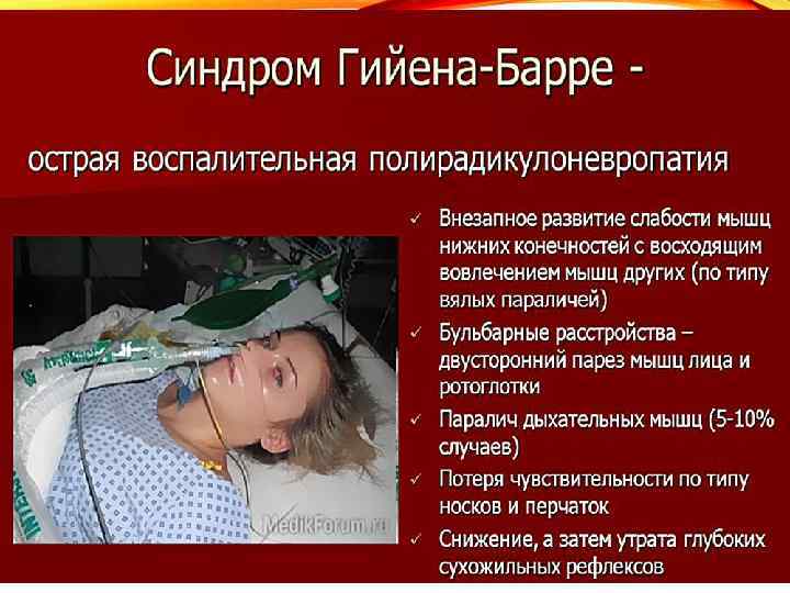 Гийена барре неврология