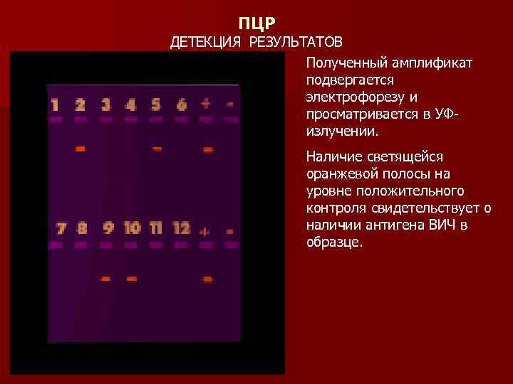 ПЦР ДЕТЕКЦИЯ РЕЗУЛЬТАТОВ Полученный амплификат подвергается электрофорезу и просматривается в УФизлучении. Наличие светящейся оранжевой