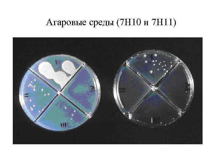  Агаровые среды (7 Н 10 и 7 Н 11) 