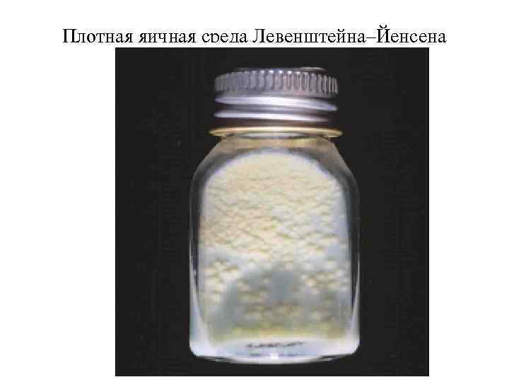Плотная яичная среда Левенштейна–Йенсена 