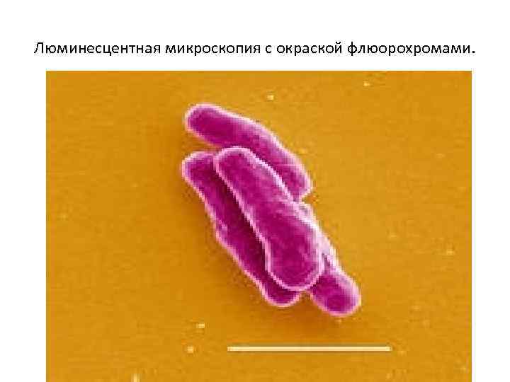 Люминесцентная микроскопия с окраской флюорохромами. 