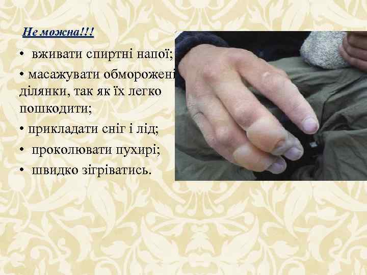 Не можна!!! • вживати спиртні напої; • масажувати обморожені ділянки, так як їх легко