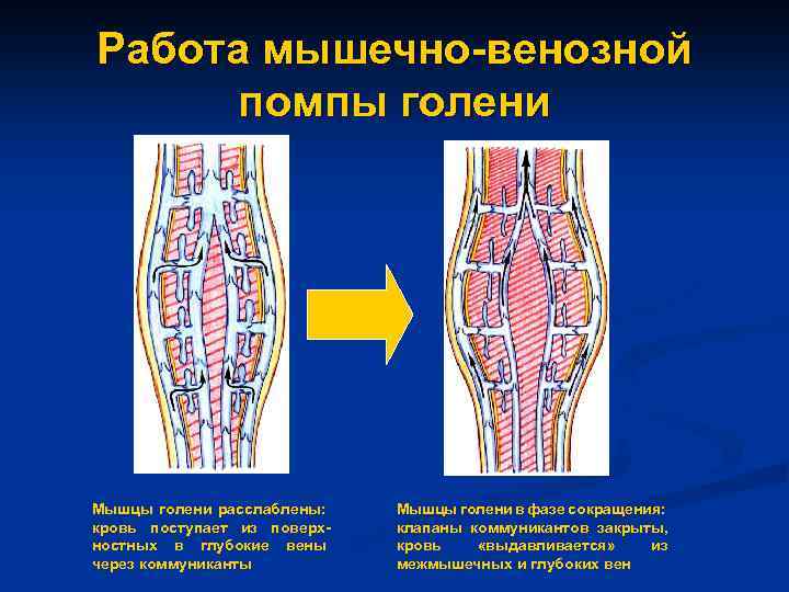 Работа мышечно-венозной помпы голени Мышцы голени расслаблены: кровь поступает из поверхностных в глубокие вены