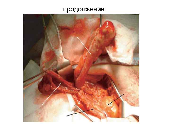 продолжение 