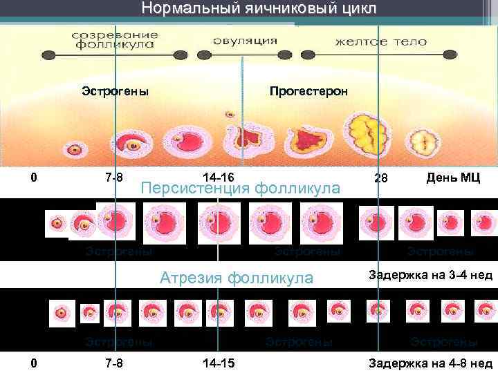 Дисфункциональное маточное кровотечение карта