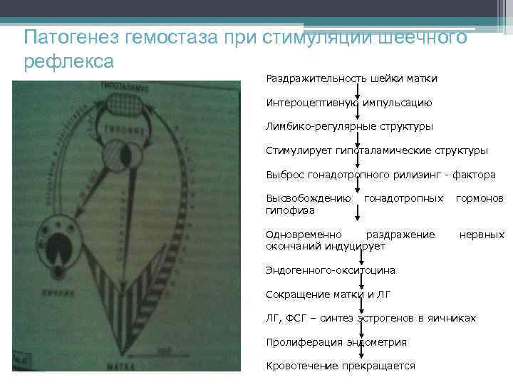 Патогенез гемостаза при стимуляции шеечного рефлекса Раздражительность шейки матки Интероцептивную импульсацию Лимбико-регулярные структуры Стимулирует