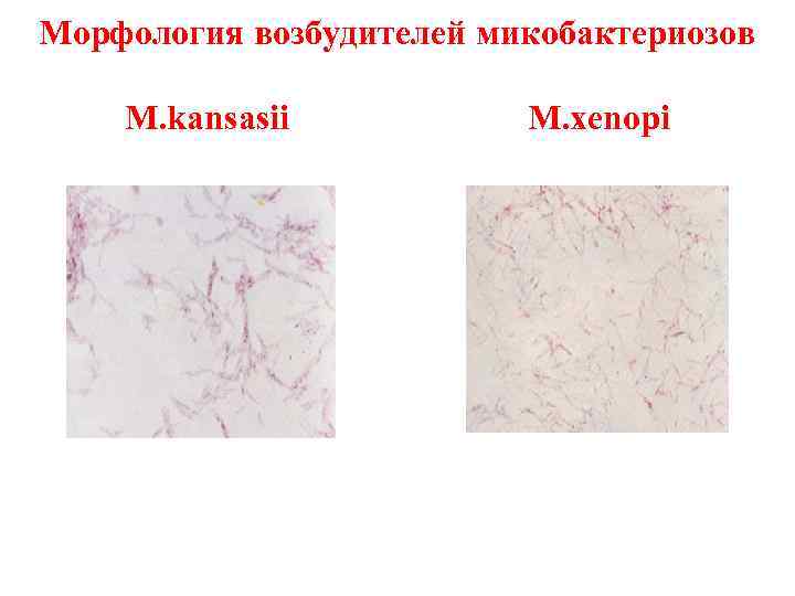 Морфология возбудителей микобактериозов M. kansasii M. xenopi 