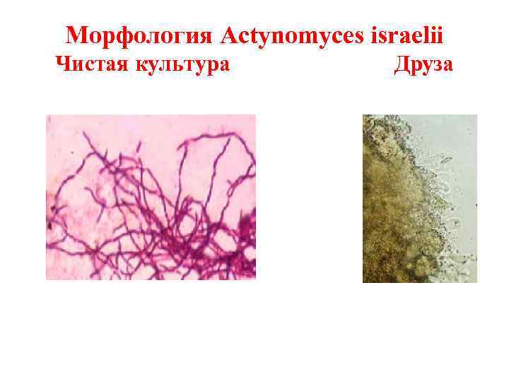 Морфология Actynomyces israelii Чистая культура Друза 