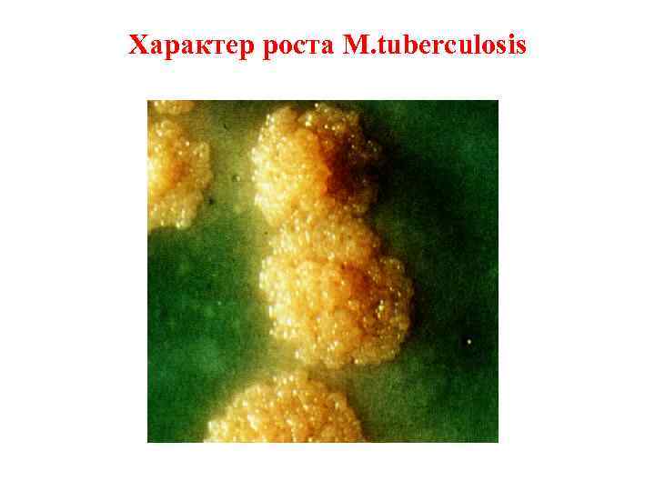 Характер роста M. tuberculosis 