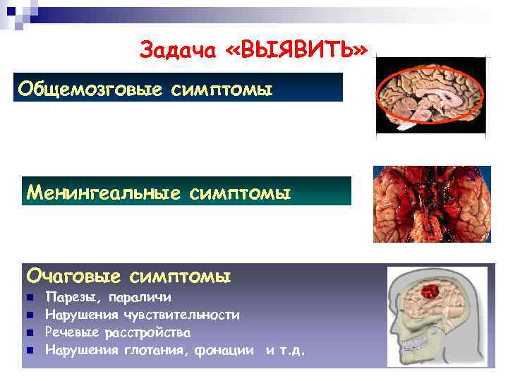 Задача «ВЫЯВИТЬ» Общемозговые симптомы Менингеальные симптомы Очаговые симптомы n n Парезы, параличи Нарушения чувствительности
