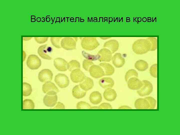 Возбудитель малярии в крови 