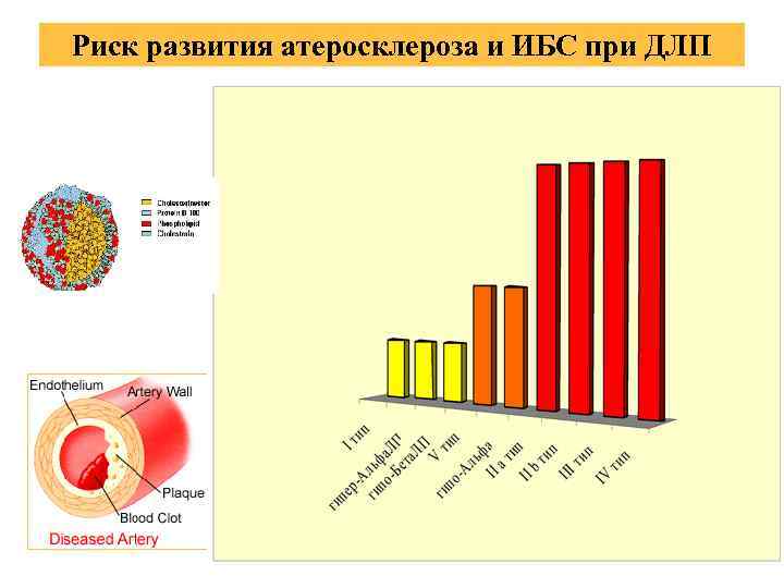 Риск развития атеросклероза и ИБС при ДЛП 