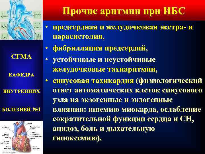 Прочие аритмии при ИБС СГМА КАФЕДРА ВНУТРЕННИХ БОЛЕЗНЕЙ № 1 • предсердная и желудочковая