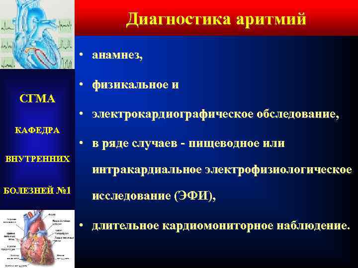 Диагностика аритмий • анамнез, • физикальное и СГМА • электрокардиографическое обследование, КАФЕДРА • в