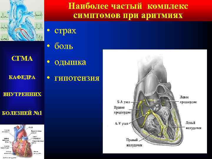 Наиболее частый комплекс симптомов при аритмиях • страх • боль СГМА КАФЕДРА ВНУТРЕННИХ БОЛЕЗНЕЙ