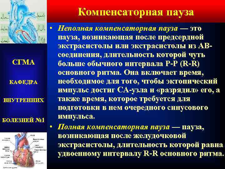 Компенсаторная пауза СГМА КАФЕДРА ВНУТРЕННИХ БОЛЕЗНЕЙ № 1 • Неполная компенсаторная пауза — это