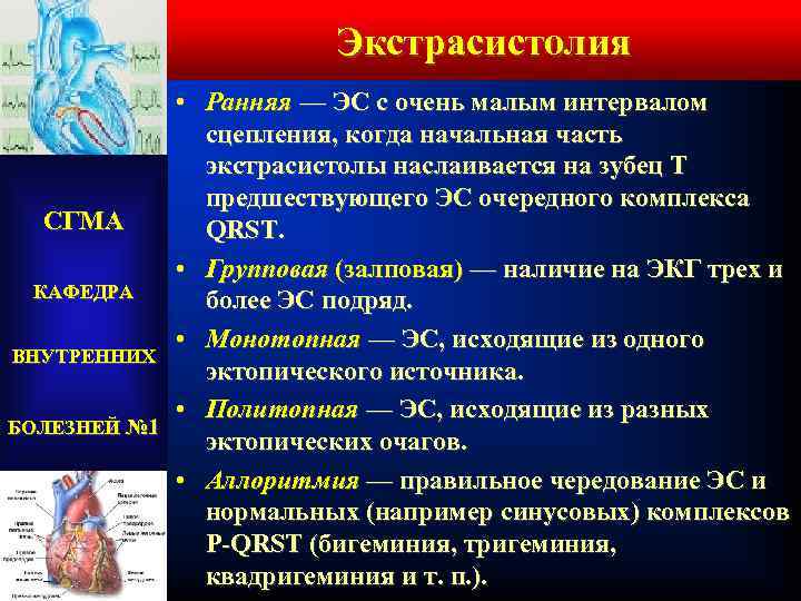 Экстрасистолия • Ранняя — ЭС с очень малым интервалом сцепления, когда начальная часть экстрасистолы