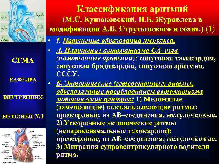 Классификация аритмий (М. С. Кушаковский, Н. Б. Журавлева в модификации А. В. Струтынского и