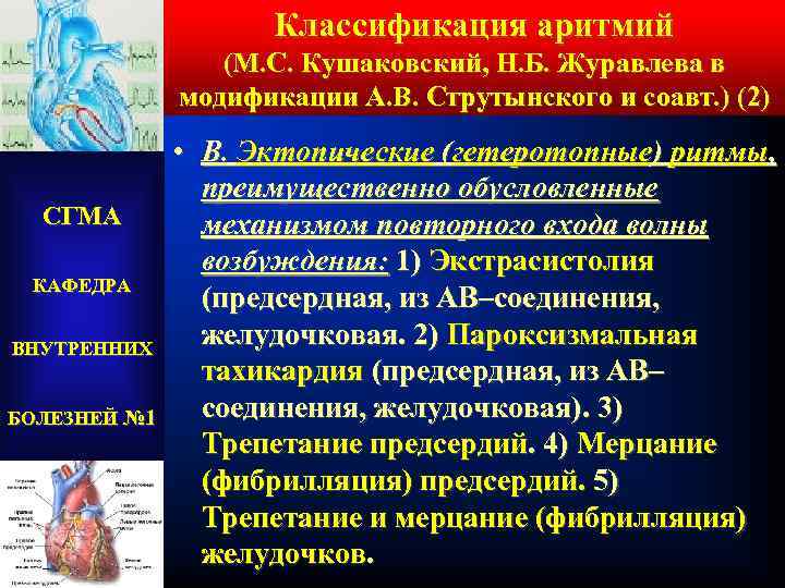 Классификация аритмий (М. С. Кушаковский, Н. Б. Журавлева в модификации А. В. Струтынского и