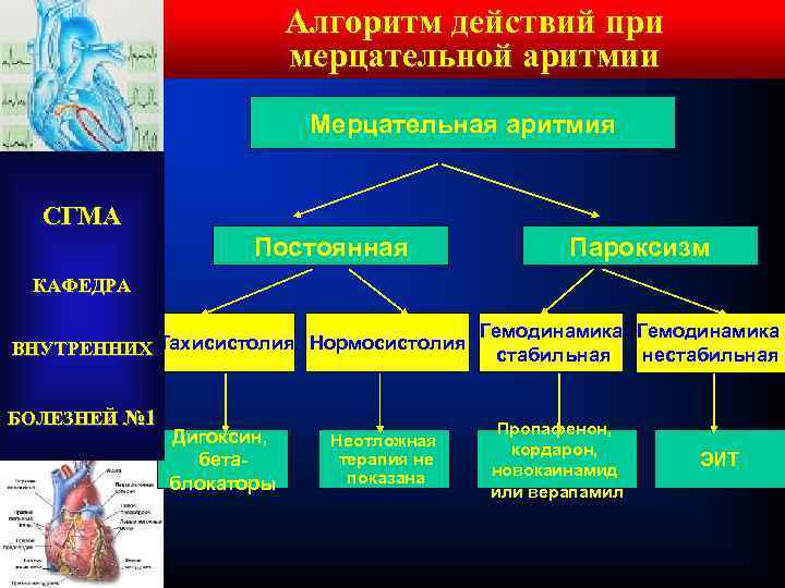 Алгоритм действий при мерцательной аритмии Мерцательная аритмия СГМА Постоянная Пароксизм КАФЕДРА ВНУТРЕННИХ Тахисистолия Нормосистолия