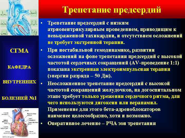 Трепетание предсердий • Трепетание предсердий с низким атриовентрикулярным проведением, приводящим к невыраженной тахикардии, и