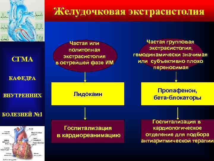 Желудочковая экстрасистолия СГМА Частая или политопная экстрасистолия в острейшей фазе ИМ Частая групповая экстрасистолия,