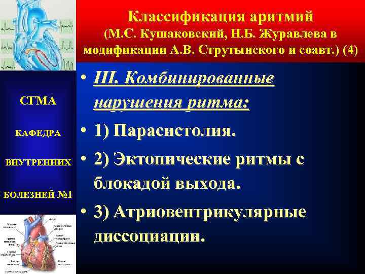 Классификация аритмий (М. С. Кушаковский, Н. Б. Журавлева в модификации А. В. Струтынского и