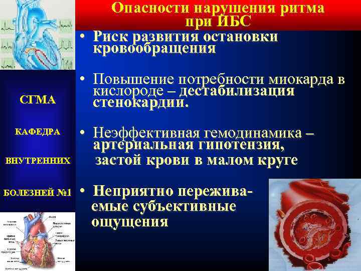 Опасности нарушения ритма при ИБС • Риск развития остановки кровообращения СГМА КАФЕДРА ВНУТРЕННИХ БОЛЕЗНЕЙ