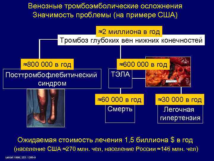 Венозные тромбоэмболические осложнения Значимость проблемы (на примере США) ≈2 миллиона в год Тромбоз глубоких