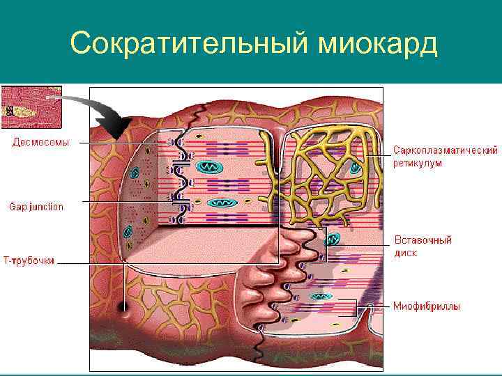 Сократительный миокард 