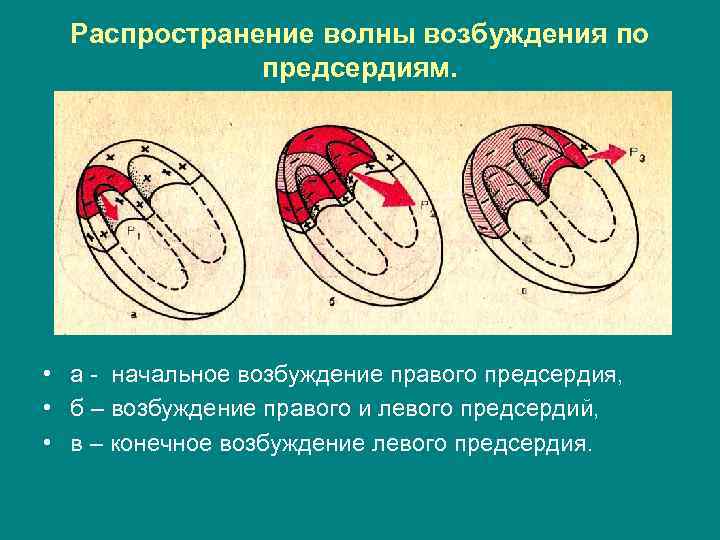 Распространение волны возбуждения по предсердиям. • а - начальное возбуждение правого предсердия, • б