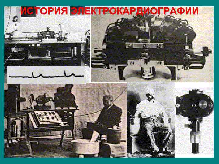 ИСТОРИЯ ЭЛЕКТРОКАРДИОГРАФИИ 