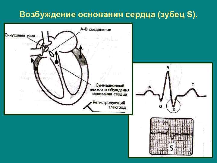 Возбуждение основания сердца (зубец S). 