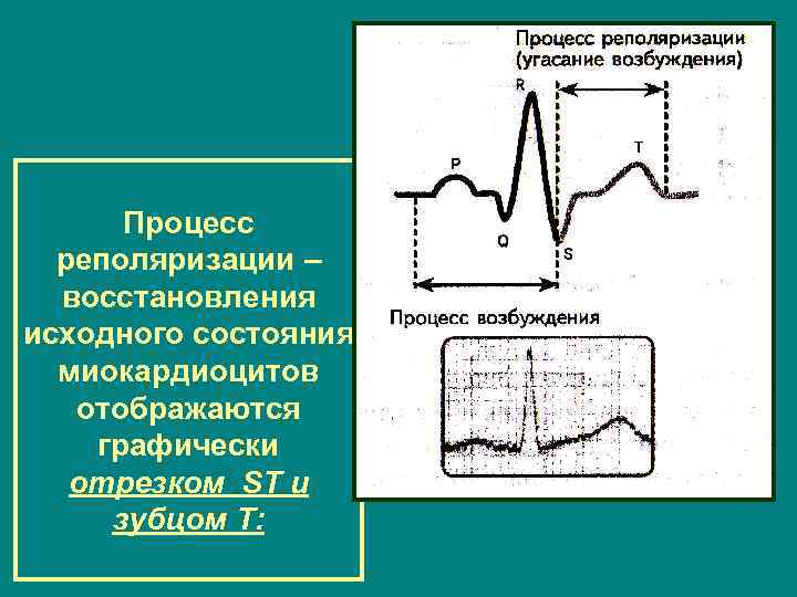 Процесс реполяризации – восстановления исходного состояния миокардиоцитов отображаются графически отрезком ST и зубцом Т: