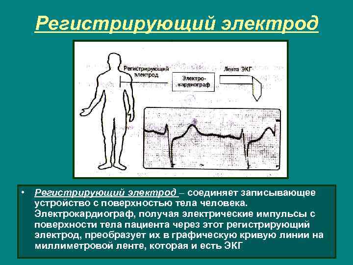 Регистрирующий электрод • Регистрирующий электрод – соединяет записывающее устройство с поверхностью тела человека. Электрокардиограф,
