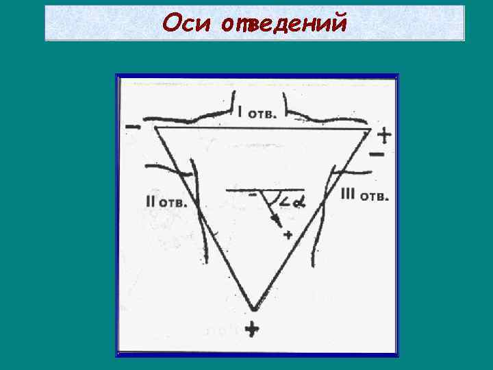 Оси отведений 